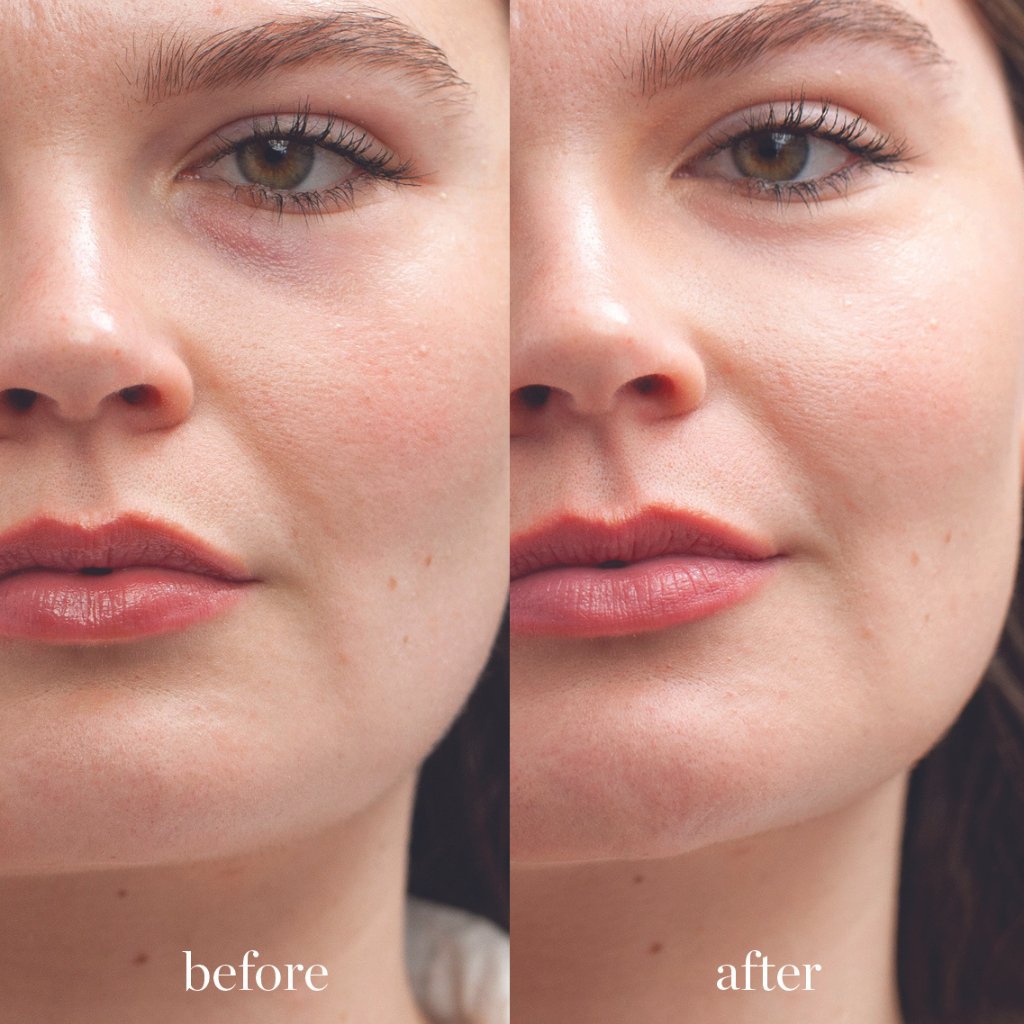 Lychee Crème Corrector - NaturelleShop.com - Ere Perez