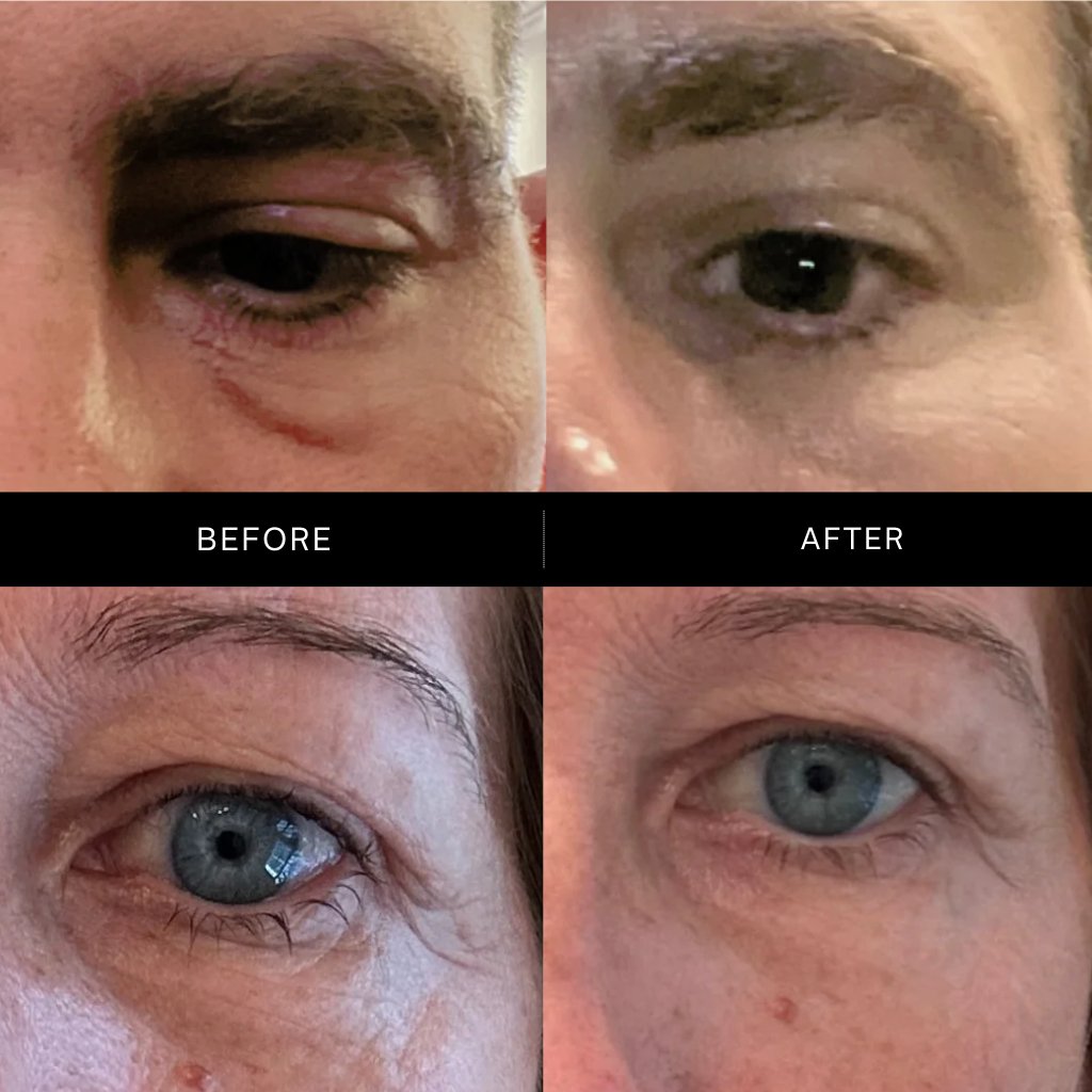 The Advanced Eye Response Complex Retinol Cream - NaturelleShop.com - Maya Chia