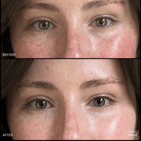 Revitalize Hydra Concealer - NaturelleShop.com - RMS Beauty